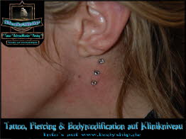Hals Dermal Anchor Microdermal Glitzer Piercing Bodymod by Bodyship Halle - Sachsen Anhalt -  www